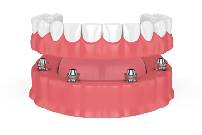 Team of Comfort Dental