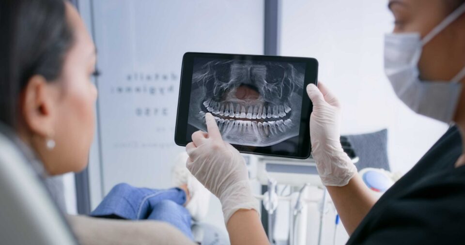 A woman examines a dental X-ray image on a tablet in a dental office in San Jose, CA
